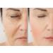 Buy Vitality Tretinol Gel 0.50% - Enhance Skin Texture & Reduce Wrinkles | International Shipping - Buy Online on GoSupps.com