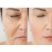 VITALITY PRECISION SKIN 15% Glycolic Cream - Anti-Aging Exfoliating Skincare for Radiant Complexion | International Shipping Available - Buy Online on GoSupps.com