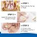 Effective Toenail Fungus Treatment - Restore Healthy Nail Appearance - Buy Online on GoSupps.com