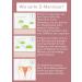 N1 D Mannose Direct Sticks - 150 PCS | Bladder & Urinary Tract Infection Relief | No Antibiotics No Water Delicious Taste | 150 Days Supply (5 Pack) - Buy Online on GoSupps.com