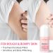 Strawberry Legs Treatment for Women | Bump Eraser Body Scrub & Keratosis Pilaris Cream | Smoothing Buffing Body Care - Buy Online on GoSupps.com