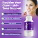 AURA VITAMINS - Vitiligo Capsules 60 Count | 1 Month | Improve Skin Pigmentation Support and Reduce White Spots | Effective Vitiligo Supplement | Natural Solution for White Spots on Skin. (1) - Buy Online on GoSupps.com