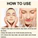 Turmeric Dark Spot Masks Acne Treatment Hyperpigmentation Treatment Contain Turmeric Vitamin C and Kaolin Clay Deep Cleansing and Reduce Acne Dark Spots Face Masks Skincare. - Buy Online on GoSupps.com