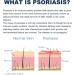 TGMALL 2023 Psoriasis Treatment Spray & Soothing Ointment - Skin Cleansing Relief (3pcs) - Buy Online on GoSupps.com