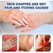 EXQST Foot Cream with 42% Urea for Dry and Cracked Heels Repair Hand and Foot Cream Stick Moisturizing Lotion for Dry Cracked Feet Heel Repair - Buy Online on GoSupps.com