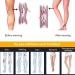 Haodasi Class 2 Medical Compression Pantyhose - Graduated Support Hosiery for Varicose Veins - Women's Beige Compression Stockings - Buy Online on GoSupps.com