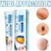 Skin Tag Remover Cream Wart Removal Cream Skin Tag Remover for Face & Hands & Body Wart Removal for Hands and Body Skin Tag Remove with Natural Ingredients Easy Use at Home 20 g - Buy Online on GoSupps.com