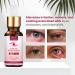 Stye Eye Treatment & Chalazion Remover | Fast Relief Serum by RUIGEQIJI - Buy Online on GoSupps.com