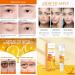 Vitamin C eye Cream 20gVitamin Essence anti-Wrinkle Anti-aging Lighten dark circles Improve Crow's Feet Eye Care Anti-Edema and eye Bags Moisturizing Eye Cream - Buy Online on GoSupps.com