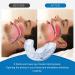 High-Quality Bissing Rails & Anti-Snoring Devices | Night Mouth Guard for Teeth Protection & Bruxism Prevention - Buy Online on GoSupps.com