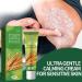 Chinese Herbal Psoriasis Cream - Natural Skin Ointment for Psoriasis Relief - Buy Online on GoSupps.com