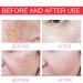 Brightening Clearing Serum Dark Spot Lightening Lotion Faded Serum for Dark Spots Faded Serum Faded Serum For Scars And Dark Spots Effectively Lighten Melanin Deposits and Skin Tone - Buy Online on GoSupps.com