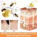 Buy Vitiligo Bee Venom Treatment Cream - Natural Skin Cream for Vitiligo (3PCS) | Effective Topical Solution - Buy Online on GoSupps.com