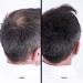 Super Million Hair Fibers - High-Quality Light Gray Hair Thickening - 15g | International Shipping Available - Buy Online on GoSupps.com