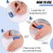 4Pcs Hypoglycemic Acupoint Clip - Sugar Control LI4 Acupressure Point for Anxiety Relief (Black) | International Shipping - Buy Online on GoSupps.com