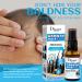 Growth Hair Oil Spray - Repair Follicles & Strengthen Roots | DHT Blocker | Nourishing 30ml - Buy Online on GoSupps.com