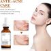 Retinol Serum for Face Retinol 0.2% in Squalane Reduce the Appearances of fine Lines of Photo Damage and of General Skin Ageing Acne Reduced Brighten & Smooth Skincare for Women & Men - Buy Online on GoSupps.com