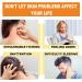 WOSLXM Bee Venom Psoriasis Treatment Cream - Professional Soothing & Moisturizing Formula for All Skin Types (3PCS) - Buy Online on GoSupps.com