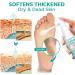 Professional Callus Remover Extra Strength Spray Foot Callus Removal Spray Foot Peeling Spray for Remove Dead Skin and Calluses on Feet (2Pcs) - Buy Online on GoSupps.com