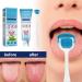 Tongue Cleaning Kit - Oral Care Gel & Brush for Breath Freshness | 2 Sets to Combat Oral Thrush & Remove Tongue Coating - Buy Online on GoSupps.com
