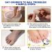 Overnight Toenail Treatment - Extra Strength Nighttime Nail Patches | 32 Hydrogel Patches for Visible Results in 8 Hours - Buy Online on GoSupps.com