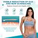 Silicone Scar Sheets Tape (1.6 x 60 Roll) - Professional Scar Removal for Surgical Scars, Keloid, C-Section, Burn, Acne - Brown - Buy Online on GoSupps.com