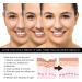 Rosehip Oil for Face Lilinas Oil for Face Castor Blackseed Rosehip Serum Lalenas Oil for Face Castor Blackseed Rosehip Serum Solving Skin Care Worries (3PCS) - Buy Online on GoSupps.com