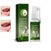 Ulcer Breath Sprays Canker Relief Spray Antiviral Mouth Spray Treat Mouth Ulcer Herbal Mouth Spray Ulcer Pain Relief Spray Breath Spray for Bad Breath Dry Mouth Relief Oral Ulcer Treatment 20ml