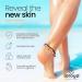 loroya - The Original - Exfoliating Foot Cream 30% Urea 250 ml - For Dry and Cracked Skin - Scar Removal - Peach Oil and Lanolin Based - Accelerates Regeneration - Buy Online on GoSupps.com