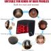 Bonnet De Croissance des Cheveux 215 LED 660 nm Et 850 nm R Glage 5 Vitesses + Synchronisation pour La Perte Cheveux/Favoriser Cheveux - Buy Online on GoSupps.com