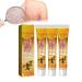 HEKEWER Psoriasis Treatment Cream Youth Bee Venom Psoriasis Treatment Cream New Zealand Bee Venom Professional Psoriasis Treatment Cream BeeVenom Soothing Psoriasis Cream for All Skin Types (3pcs)
