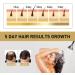 Ginger Hair Growth Shampoo Ginger Shampoo Anti hair Loss Shampoo Hair Regrowth Treatment for Men Woman Mens Shampoo Hair Growth Shampoo and Conditioner Anti Dandruff Shampoo Men - Buy Online on GoSupps.com