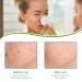 Dermisklean Acne Control Pads - Glycolic Acid Exfoliating Facial Pads for Acne Treatment Oil Control and Hydration | 60 Pads - Buy Online on GoSupps.com