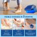 Nail Fungus Cleaning Device for Multiple fingers 905nm Infrared Light + 470nm Blue Light Highly Effective Treatment for Home Use Treat and effectively prevent (Navy) - Buy Online on GoSupps.com