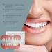Rapid Smile Denture Reline Set Upper and Lower Dentures Kit Rapid Smile Moldable False Teeth Fast to Installation Fast to Use 2025 - Buy Online on GoSupps.com