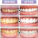 Tooth Gloss - 2023 Instant Teeth Whitening Pen & Cleaning Essence - Achieve Glossy Teeth & Remove Stains (1PCS) - Buy Online on GoSupps.com