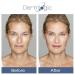 Dark Spot Corrector Serum | Fades Age Spots Acne Scars & Freckles | Kojic & Hyaluronic Acid  - Buy Online on GoSupps.com