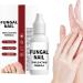 Whrcy Fingernail repair drops Damaged Hands Feet Nails Repair Solution 15ml Deep Hydration Booster with Precise Dropper for All Seasons Teens Adults Women - Buy Online on GoSupps.com