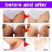Brightening Intimate Parties Whitening Cream for Intimate Parts Intimate Cream Woman Irritation Brightening Armpit Cream Bleaching Cream for Private Parts (1) - Buy Online on GoSupps.com