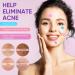 Senhorita 144Pcs Colorful Hydrocolloid Acne Patches with Green Algae Extract & Tea Tree Oil - Cover, Reduce Zits, Pimples, Blemishes - 144 Count - Buy Online on GoSupps.com