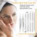 CiciIng Blackhead Remover Tool 9-in-1 Stainless Steel Pimple Extractor Set with Non-slip Handle Includes Pimple Patch for All Skin Types Silver - Buy Online on GoSupps.com