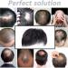 Hair System Men | Men's Toupee | Hair Replacement Patch Men Men's Toupee V-Shape Hairline Hair Extension Real Human Hair Invisible Forehead Hairpiece Natural Hairpiece for Men - Buy Online on GoSupps.com