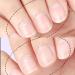 Nail Care Pen Autriche pour ongles et ongles des pieds soign s Soin cosm tique en cas d' fongique des ongles rapidement efficace avec de l'huile d'arbre th  - Buy Online on GoSupps.com