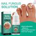 Extra Strong Fungal Nail Treatment 10ML - Toe & Finger Nail Fungus Solution - Strengthen, Repair & Renew Damaged Nails - 2Pcs - Buy Online on GoSupps.com