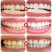 Sp-6 Fresh Breath Toothpaste Sp-6 Probiotic Toothpaste Sp-6 Toothpaste Probiotic Toothpaste Fresh Breath Toothpaste Removes Stains Complete Dental Care - Buy Online on GoSupps.com