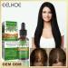 Rosemary Hair Growth Essential Oil - 30ml | Hair Loss Care Scalp Nourishment & Regrowth Serum for Men & Women | 3 Pcs for Dry Damaged Hair - Buy Online on GoSupps.com