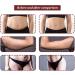 Buy Ear-Seed Acupuncture Stickers & Multi-State Acupressure Sets | Facial Reflex Massage Tools - Shop Internationally! - Buy Online on GoSupps.com