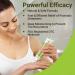 LMNOOP Psoriasis Cream - Maximum Strength Fast-Acting Moisturizing Relief for Dry Sensitive Skin (1.76oz / 50g) - International Shipping Available - Buy Online on GoSupps.com