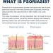 Tonkog Youth Bee Venom Psoriasis Treatment Cream - Professional New Zealand Formula for All Skin Types (8PCS) - Buy Online on GoSupps.com