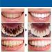Prediotics Whitening Toothpaste with Probiotics - SP-Y6 for Healthy Teeth & Gums (1pc) - Best International Shipping - Buy Online on GoSupps.com